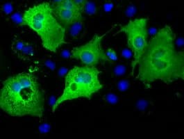 IFT57 / HIPPI Antibody (clone OTI1H2)
