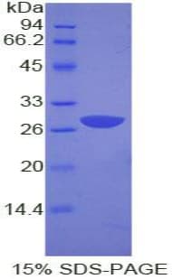 Human GRB2 Protein (Recombinant His-T7)
