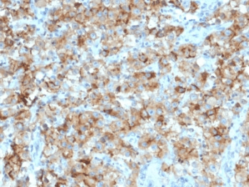 Monoclonal Mouse anti-Human STAR Antibody (clone STAR/2154, Azide-free,BSA-free, IHC)