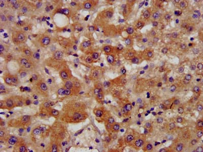 Polyclonal Rabbit anti-Human NSDHL Antibody (IHC, IF, WB)