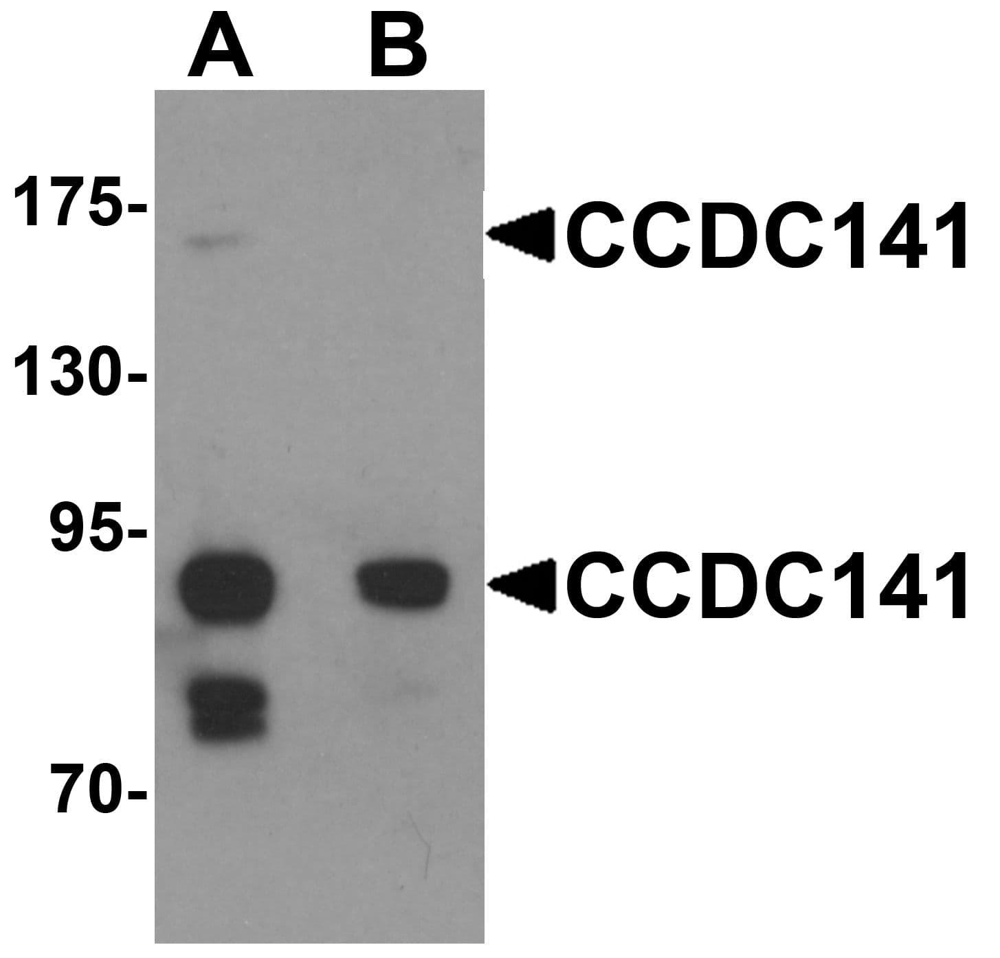 IHC-plus™ CCDC141 Antibody