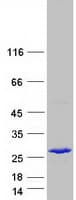 Human NIPSNAP3B Protein (Recombinant Myc-DDK (Flag))