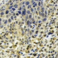 ABO Glycosyltransferase Antibody