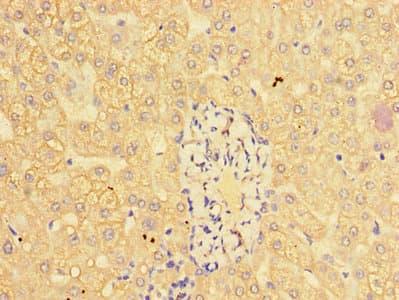 Polyclonal Rabbit anti-Human CTSL / Cathepsin L Antibody (IHC, IF)