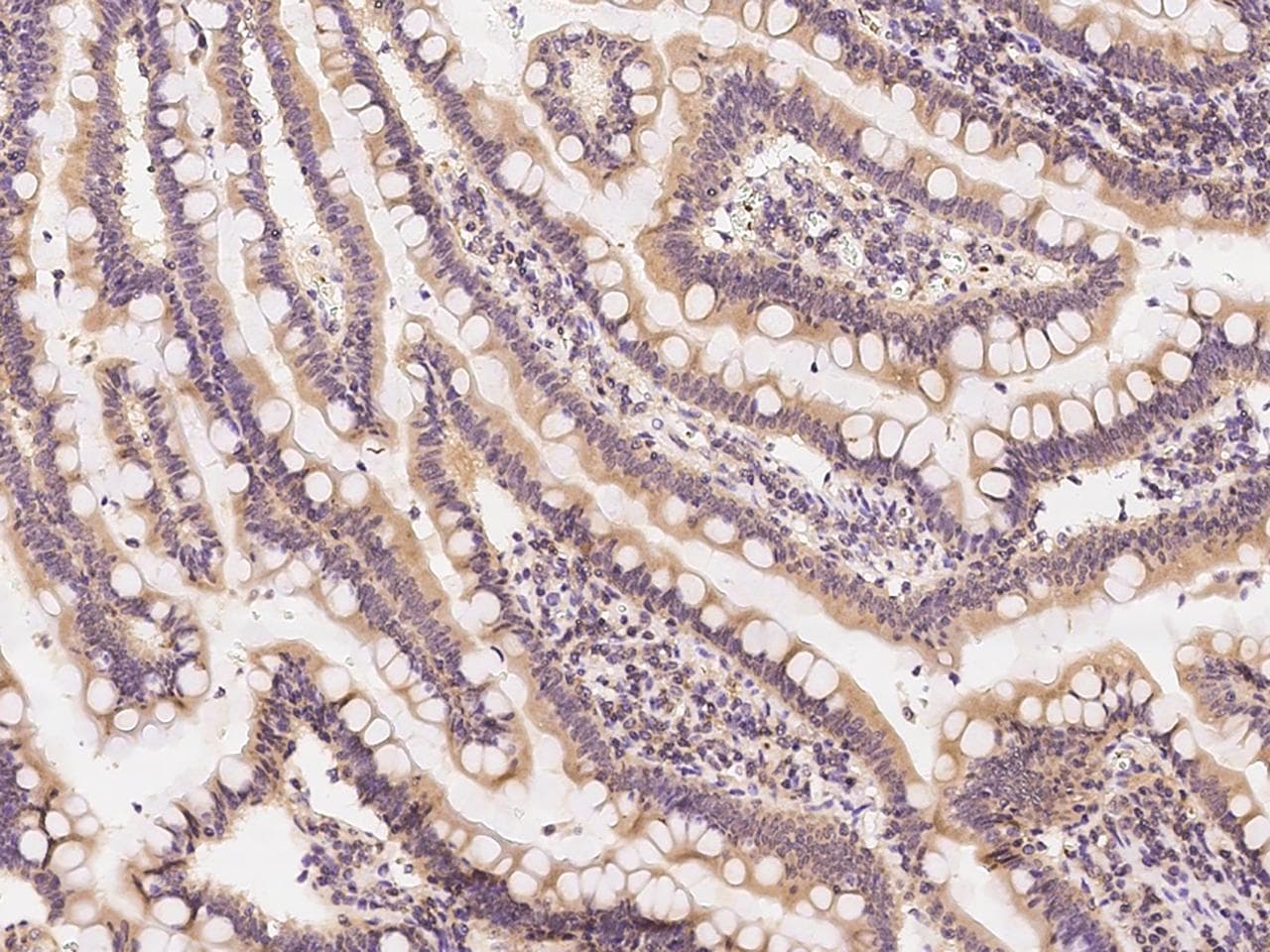 OSBPL2 Antibody