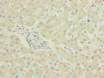 Polyclonal Rabbit anti-Human UQCC2 / MNF1 Antibody (IHC, WB)