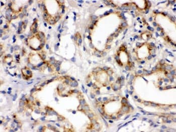 FZD1 / Frizzled 1 Antibody