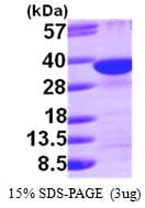Human SDCBP / Syntenin Protein (Recombinant His)