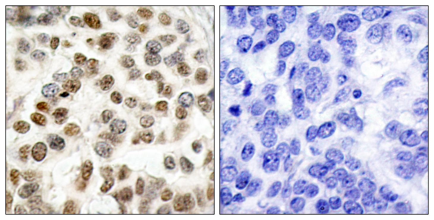 BRCA1 Antibody (p1423)