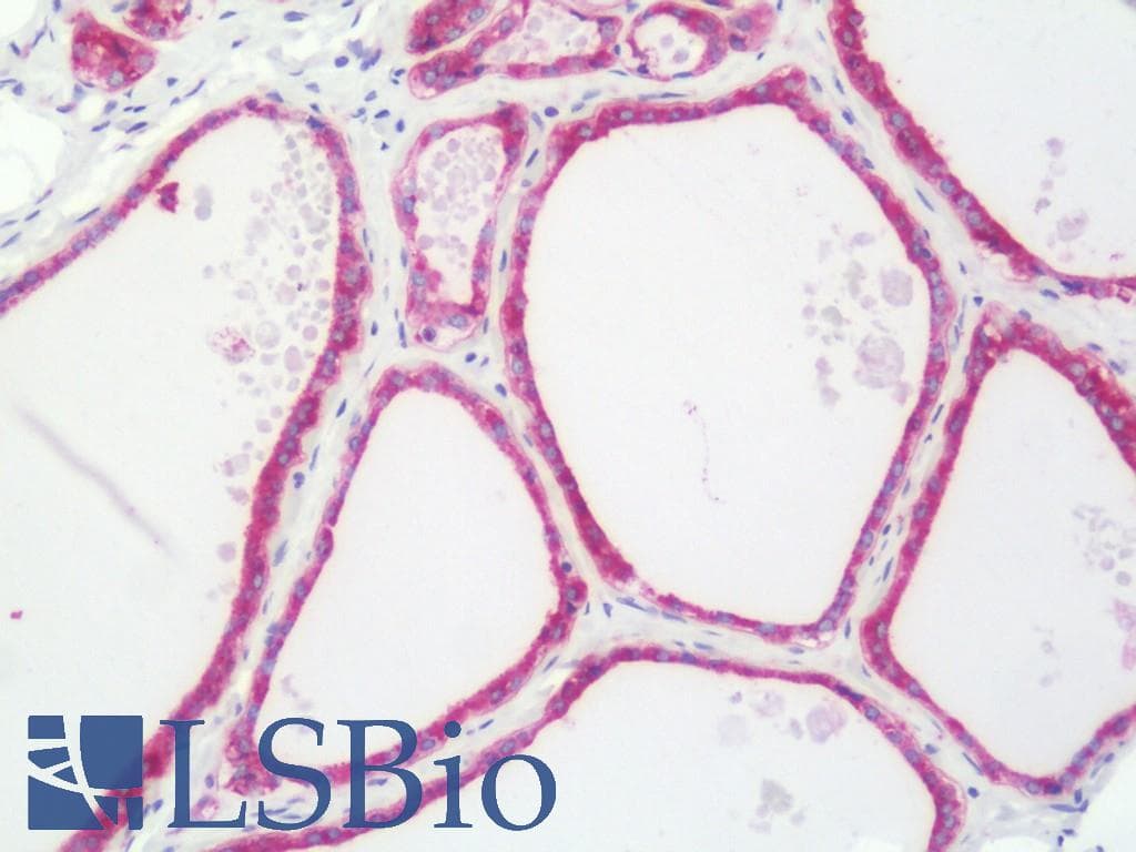 IHC-plus™ Polyclonal Rabbit anti-Human PFKP Antibody (aa350-400, IHC, WB)