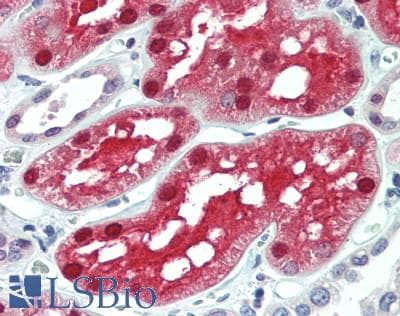 GIPC2 Antibody (aa1-315)
