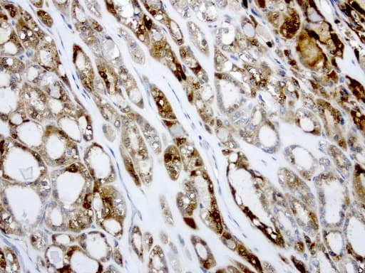 LGALS3 / Galectin 3 Antibody (clone UMAB189, Carrier-free)