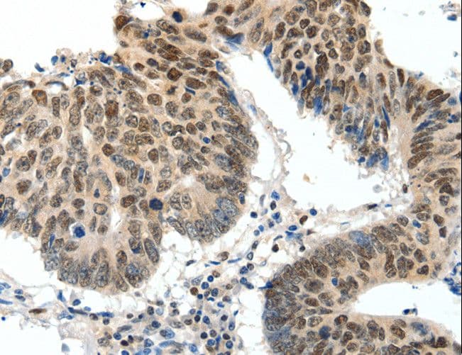 IHC-plus™ TOP2A / Topoisomerase II Alpha Antibody