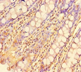 ZBTB46 Antibody