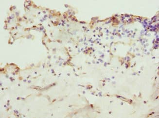 Polyclonal Rabbit anti-Human ZNF549 Antibody (IHC, WB)
