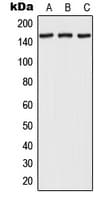 Polyclonal Rabbit anti-Human RPAP1 Antibody (Internal, WB)