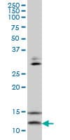 VAMP1 / VAMP-1 Antibody (clone 5A4)
