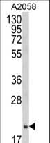 IHC-plus™ Polyclonal Rabbit anti-Human FTH1 / Ferritin Heavy Chain Antibody (aa154-183, IHC, WB)
