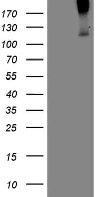 Monoclonal Mouse anti-Human Betaglycan / TGFBR3 Antibody (clone OTI6B2, aa531-777, WB)
