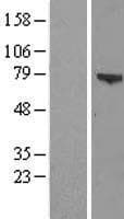 ZSWIM3 Protein (Over-Expression Lysate Myc-DDK (Flag))