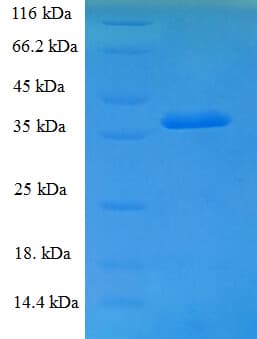 Human GNPDA1 Protein (Recombinant His)