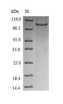 Human CHM / REP1 Protein (Recombinant 6His, N-terminus)