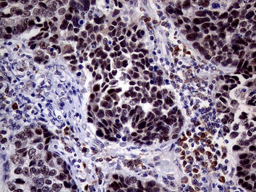 TOP1 / Topoisomerase I Antibody (aa93-151, clone OTI3B9)