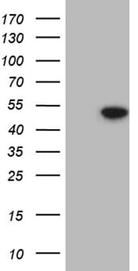 HDAC8 Antibody (aa1-243, clone OTI5F7)