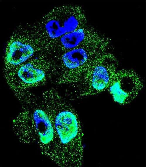IHC-plus™ Polyclonal Rabbit anti-Human TIMP1 Antibody (aa157-188, IHC, IF, WB)