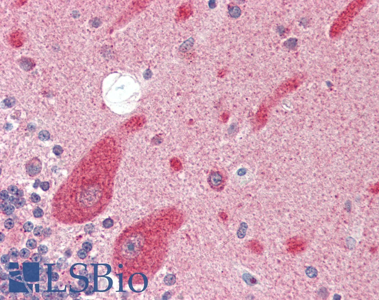IHC-plus™ GRIK4 / KA1 Antibody
