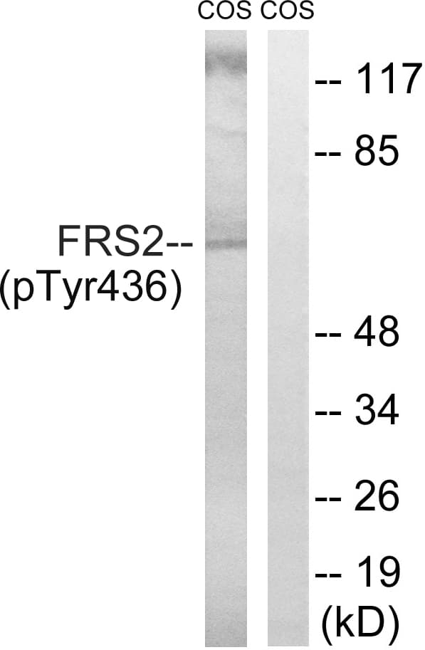 FRS2 Antibody (phospho-Tyr436)