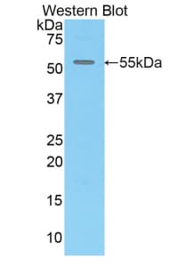 CX3CL1 / Fractalkine Antibody (aa81-337)