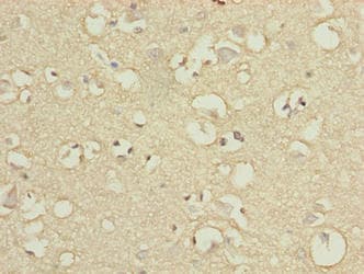 ENPP6 Antibody