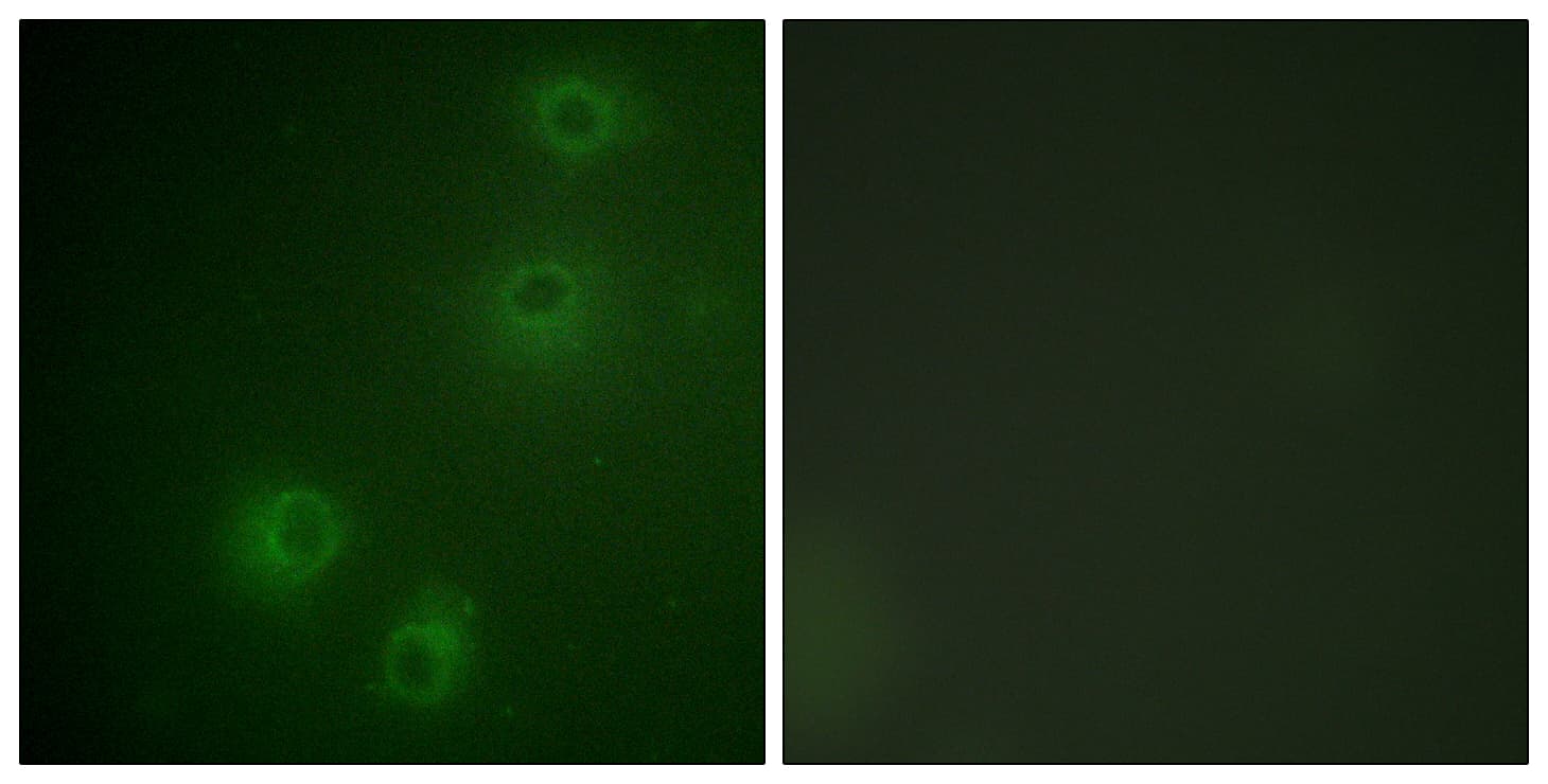Polyclonal Rabbit anti-Human ITGB1 / Integrin Beta 1 / CD29 Antibody (phospho-Thr789, IHC, IF, WB)