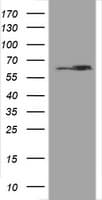 HSPD1 / HSP60 Antibody (clone OTI3G1)