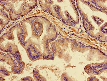 OPG / Osteoprotegerin Antibody