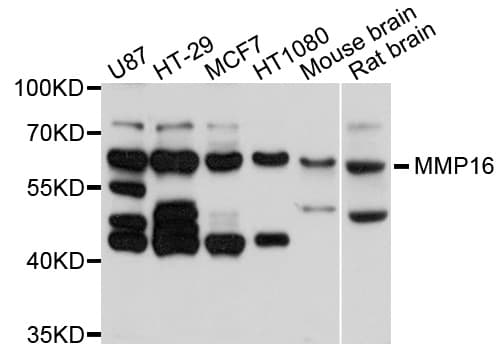 Polyclonal Rabbit anti-Human MMP16 Antibody (WB)