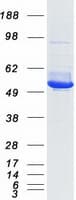 Human IDH2 Protein (Recombinant Myc-DDK (Flag))