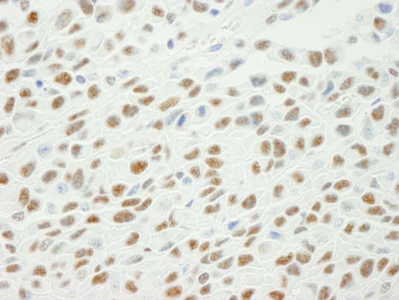 Polyclonal Rabbit anti-Human XRCC1 Antibody (phospho-Ser461, IHC)