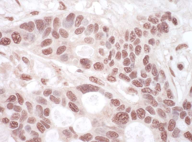 Polyclonal Rabbit anti-Human p84 / THOC1 Antibody (aa607-657, IHC, WB)