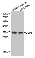 Polyclonal Rabbit anti-Human UCP3 Antibody (IHC, WB)