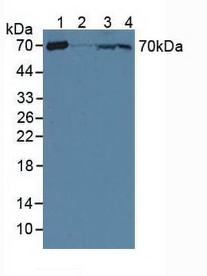 CRAT Antibody (aa1-430, APC)