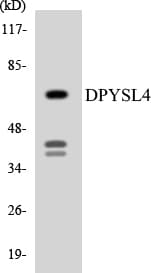 Polyclonal Rabbit anti-Human DPYSL4 / CRMP3 Antibody (aa83-132, WB)