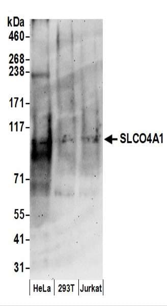 IHC-plus™ Polyclonal Rabbit anti-Human SLCO4A1 / OATP1 Antibody (aa672-722, IHC, WB)