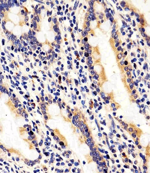RAB35 Antibody (aa166-199)