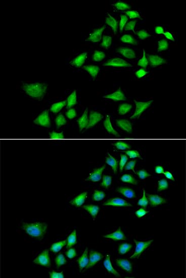KLK4 / Kallikrein 4 Antibody