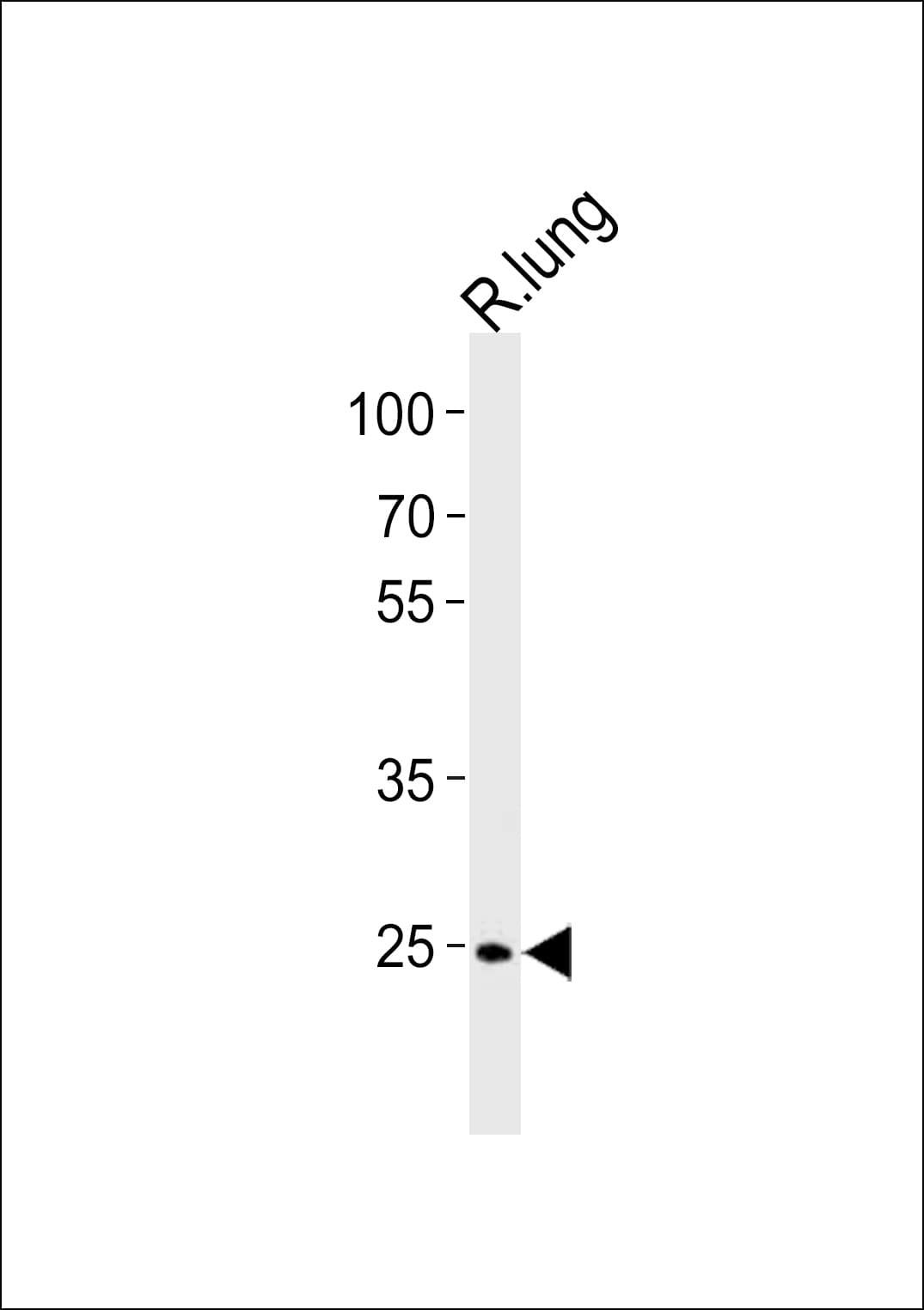 CDK4 Antibody (aa272-303)