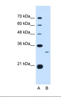 Complement C1QB Antibody (C-Terminus)