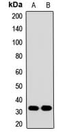 SLC25A20 / CACT Antibody