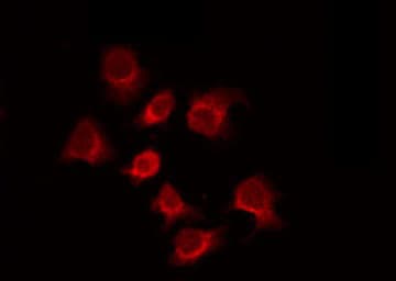 Polyclonal Rabbit anti-Human ZAR1 Antibody (IF, WB)